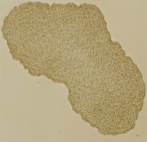 Lichtmikroskopisches Bild von Trichoplax (Individuum ca. 0,5 mm im Durchmesser) Oliver Voigt (2006)